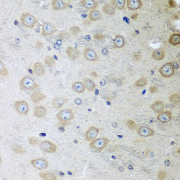 Immunohistochemistry of paraffin-embedded mouse brain using ATAD3A antibody  at dilution of 1:100 