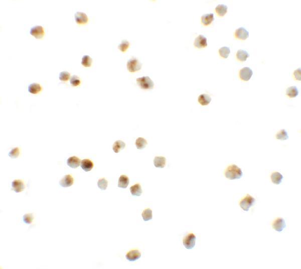 Immunocytochemistry of ATAD3A in Daudi cells with ATAD3A antibody at 20 μg/mL