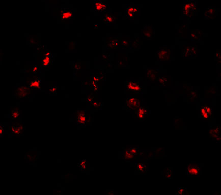 Immunofluorescence of ATAD3A in Daudi cells with ATAD3A antibody at 20 μg/mL