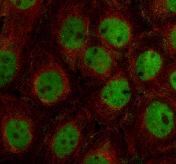 IF analysis of DEF6 using anti-DEF6 antibody (A06058-3) and anti-Alpha Tubulin antibody (M03989-3)