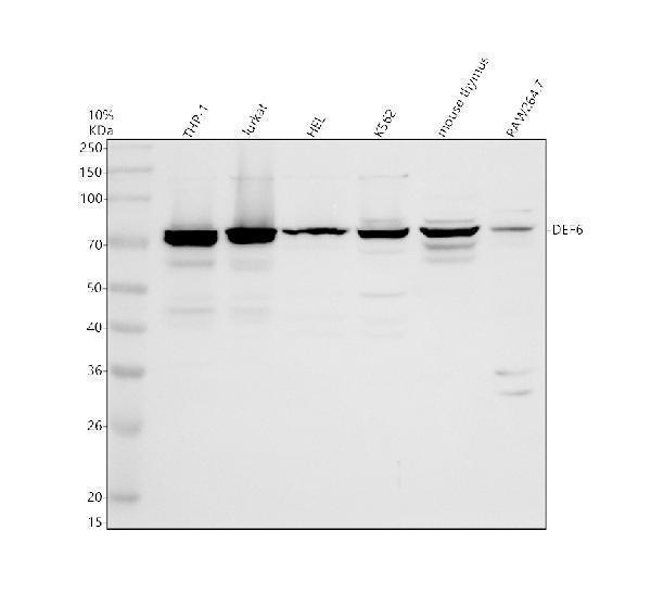 Western blot analysis of DEF6 using anti-DEF6 antibody (A06058-3)