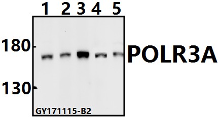 Western blot (WB) analysis of POLR3A (P68) pAb at 1:500 dilution
Lane1:PC3 whole cell lysate(40ug)
Lane2:Hela whole cell lysate(40ug)
Lane3:K562 whole cell lysate(40ug)
Lane4:C6 whole cell lysate(40ug)
Lane5:BV2 whole cell lysate(40ug)