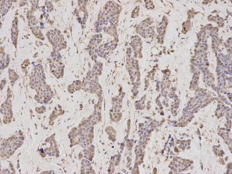 a06060 2 gmnn primary antiboties ihc testing 2