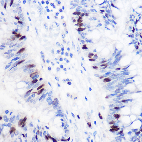 a06060 2 gmnn primary antiboties ihc testing 3