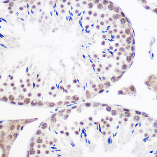 a06060 2 gmnn primary antiboties ihc testing 4