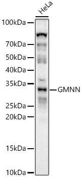 a06060 2 gmnn primary antiboties wb testing 1