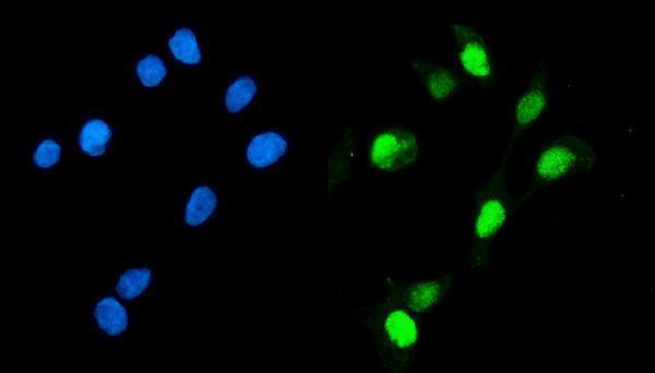 a06060 3 gmnn primary antibodies if testing 7