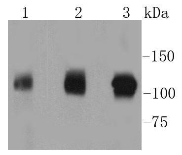 Western blot analysis of GART on different lysates using anti-GART antibody at 1/1,000 dilution