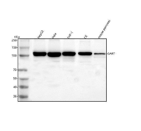  Western blot analysis of GART using anti-GART antibody (A06061-2)