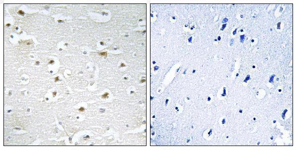 a06062 1 ddx3y primary antibodies ihc testing 1