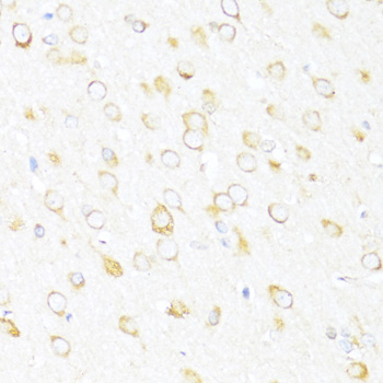 a06062 2 ddx3y primary antiboties ihc testing 3