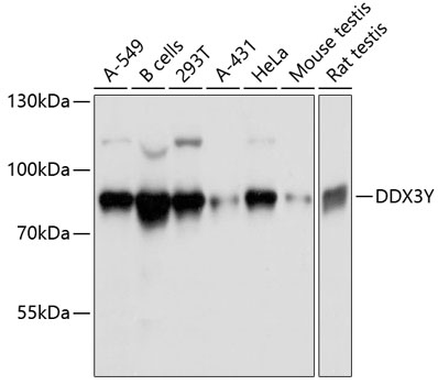 a06062 2 ddx3y primary antiboties wb testing 1