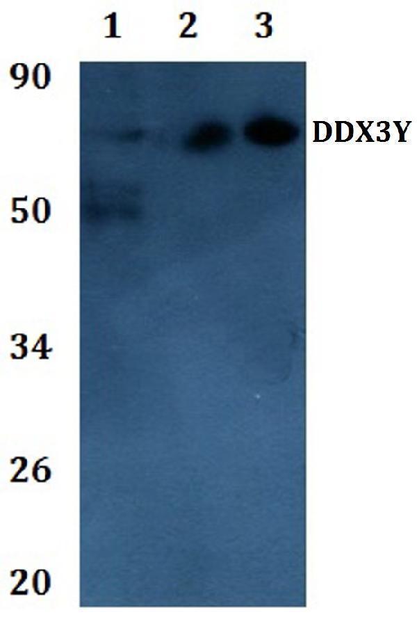 Western blot (WB) analysis of DDX3Y polyclonal antibody at 1:500 dilution 
Line1:THP-1 whole cell lysate
Line2:PC12 whole cell lysate
Line3:sp20 whole cell lysate