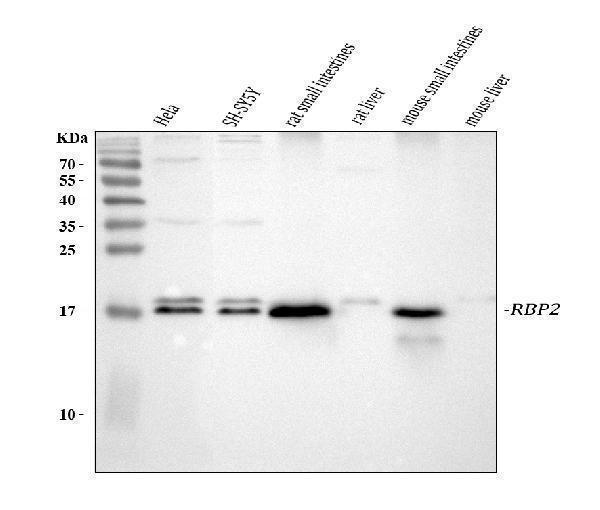  Western blot analysis of RBP2 using anti-RBP2 antibody (A06064-1)