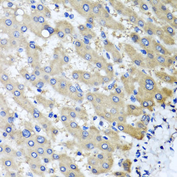 a06064 rbp2 primary antiboties ihc testing 2