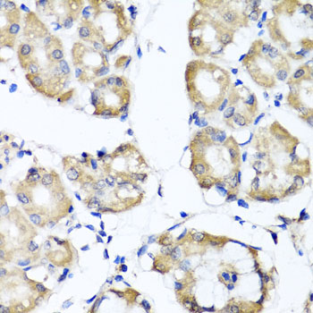 a06064 rbp2 primary antiboties ihc testing 3