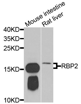 a06064 rbp2 primary antiboties wb testing 1