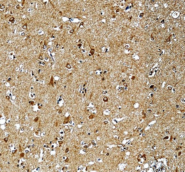 IHC analysis of PLEKHO1 using anti-PLEKHO1 antibody (A06065-1)