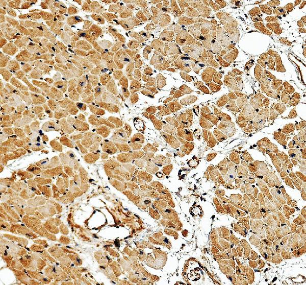 IHC analysis of PLEKHO1 using anti-PLEKHO1 antibody (A06065-1)