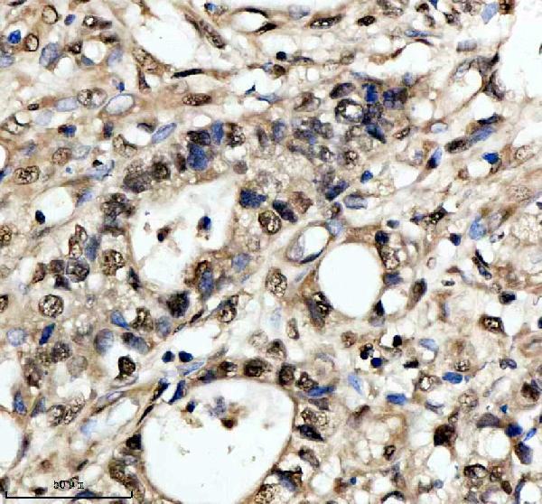 a06066 2 nusap1 primary antibodies ihc testing 1