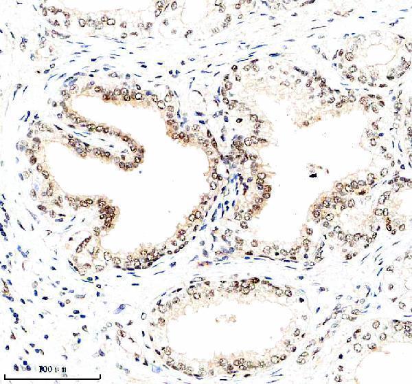  IHC analysis of NUSAP1 using anti-NUSAP1 antibody (A06066-2)
