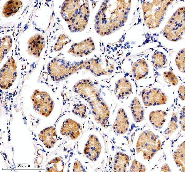  IHC analysis of NUSAP1 using anti-NUSAP1 antibody (A06066-2)