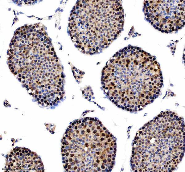 a06066 2 nusap1 primary antibodies ihc testing 4
