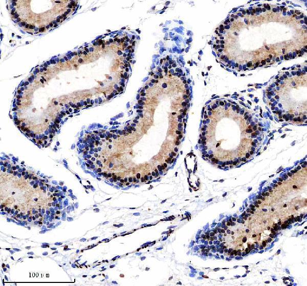 a06066 2 nusap1 primary antibodies ihc testing 5