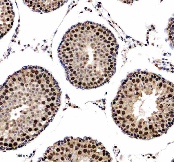 a06066 2 nusap1 primary antibodies ihc testing 6