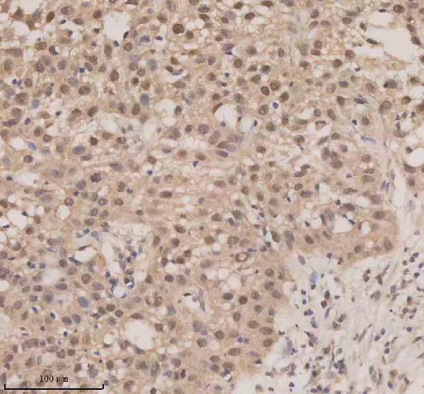 IHC analysis of ESRP1 using anti-ESRP1 antibody (A06068-1)