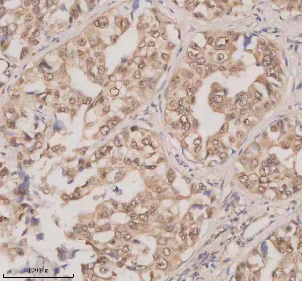 a06068 1 esrp1 primary antibodies ihc testing 2