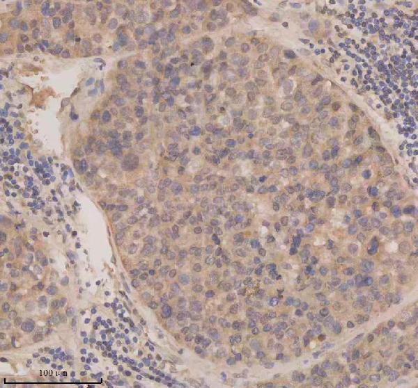 a06068 1 esrp1 primary antibodies ihc testing 3