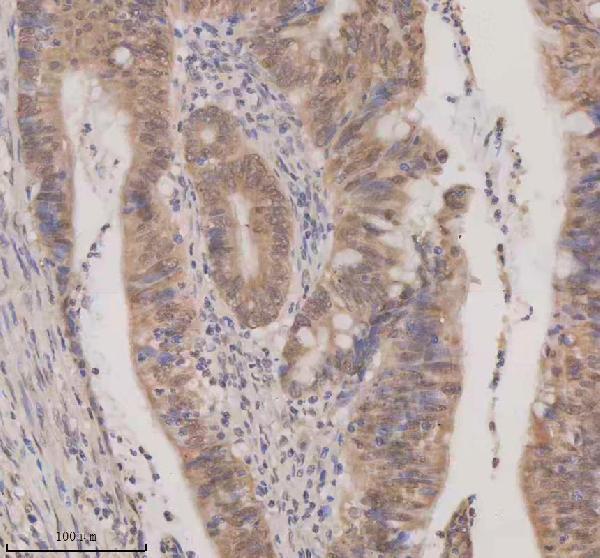 a06068 1 esrp1 primary antibodies ihc testing 4