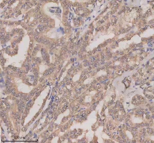 a06068 1 esrp1 primary antibodies ihc testing 5