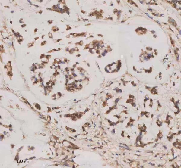 a06068 1 esrp1 primary antibodies ihc testing 6