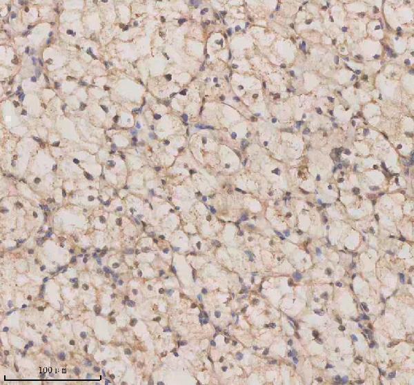 a06068 1 esrp1 primary antibodies ihc testing 7