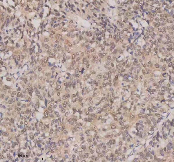 a06068 1 esrp1 primary antibodies ihc testing 8