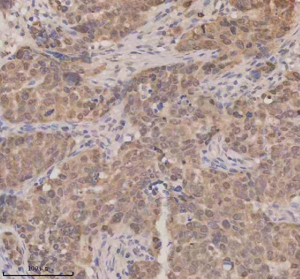 a06068 1 esrp1 primary antibodies ihc testing 9