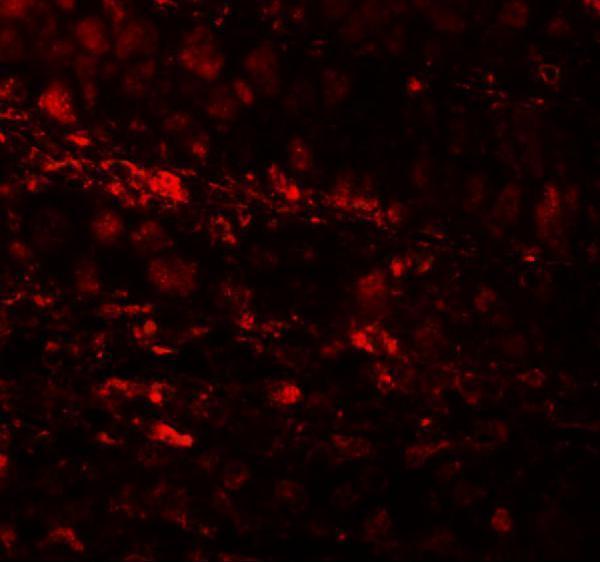 Immunofluorescence of RBM35A in human colon tissue cells with RBM35A antibody at 20 μg/mL