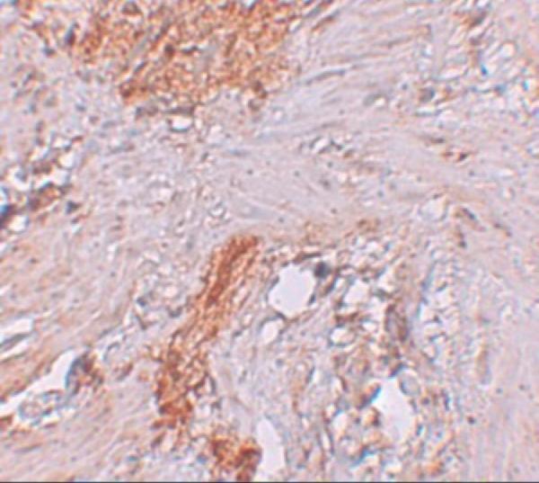 Immunohistochemistry of RBM35A in human colon tissue with RBM35A antibody at 2