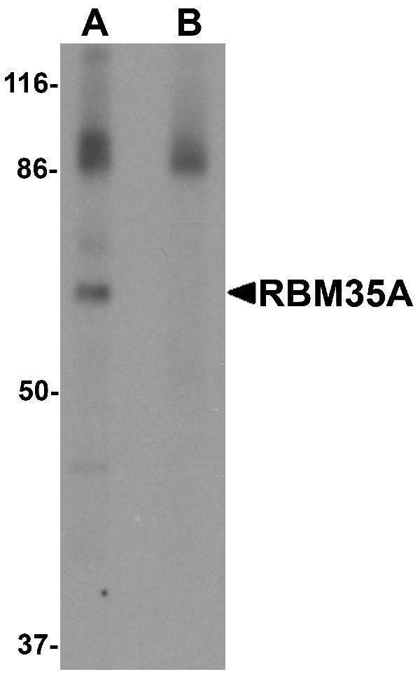 Western blot analysis of RBM35A in rat colon tissue lysate with RBM35A antibody at 0