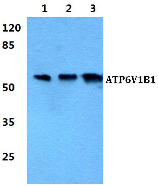 Western blot (WB) analysis of ATP6V1B1 polyclonal antibody at 1:500 dilution
Lane1:HEK293T cell lysate
Lane2:Raw264