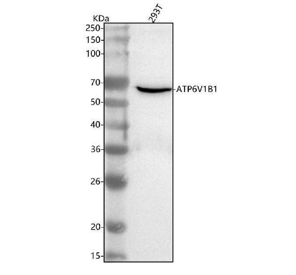  Western blot analysis of ATP6V1B1 using anti-ATP6V1B1 antibody (A06073-2)