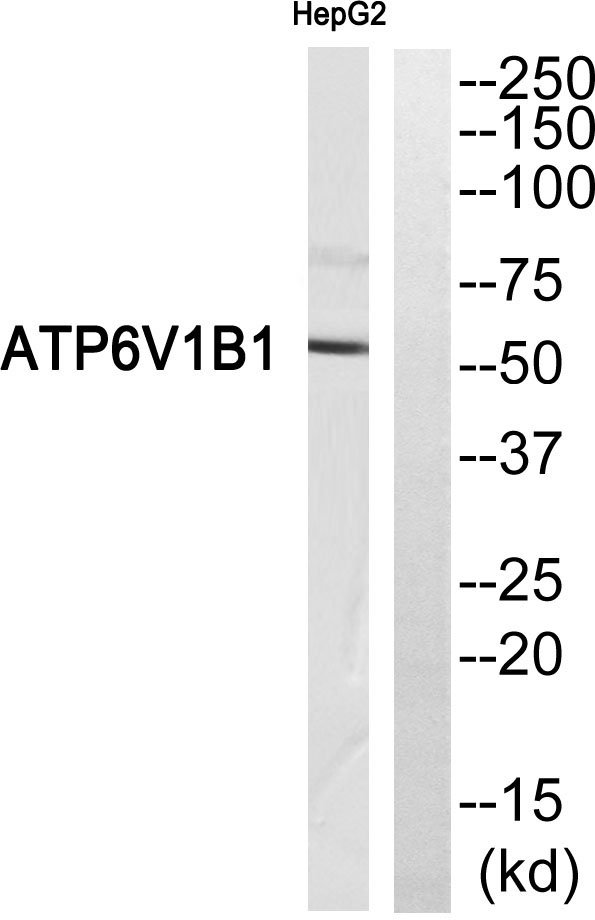 Western blot analysis of ATP6V1B1 Antibody