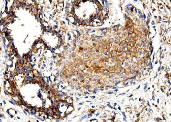 a06075 4 morc3 primary antibodies ihc testing 2