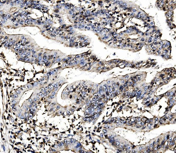 a06075 4 morc3 primary antibodies ihc testing 3