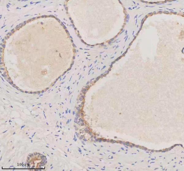 IHC analysis of Melanophilin/MLPH using anti-Melanophilin/MLPH antibody (A06081-2)