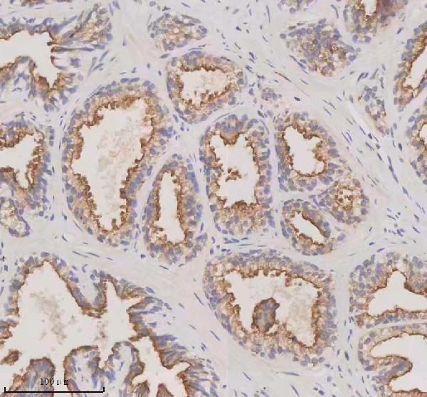 IHC analysis of Melanophilin/MLPH using anti-Melanophilin/MLPH antibody (A06081-2)