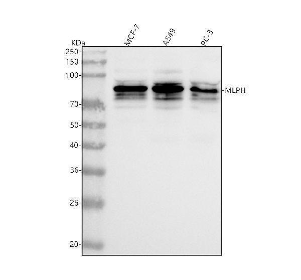  Western blot analysis of Melanophilin/MLPH using anti-Melanophilin/MLPH antibody (A06081-3)