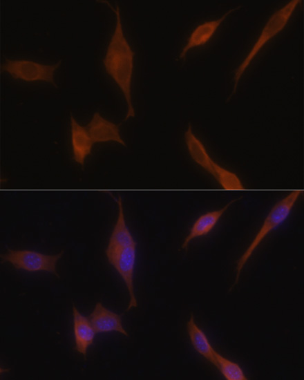 Immunofluorescence analysis of NIH-3T3 cells using MLPH antibody  at dilution of 1:100